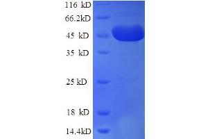 SDS-PAGE (SDS) image for DCP2 Decapping Enzyme Homolog (DCP2) (AA 1-385), (Isoform 2) protein (His tag) (ABIN4976208)