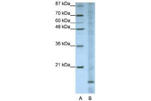 WB Suggested Anti-FAM121B Antibody Titration:  1. (APOO antibody  (N-Term))