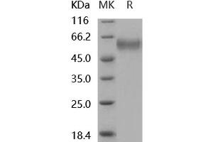 SFRP4 Protein (His tag)