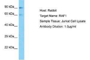 Host: Rabbit Target Name: RAF1 Sample Type: Jurkat Whole Cell lysates Antibody Dilution: 1. (RAF1 antibody  (Middle Region))