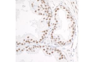 Immunohistochemistry (IHC) image for anti-DEAD (Asp-Glu-Ala-Asp) Box Polypeptide 5 (DDX5) (C-Term) antibody (ABIN7454642)