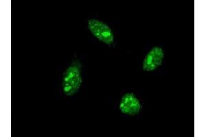 Immunofluorescence of monoclonal antibody to CDX1 on HeLa cell. (CDX1 antibody  (AA 126-215))