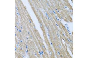 Immunohistochemistry of paraffin-embedded mouse heart using CCM2 antibody (ABIN5975413) at dilution of 1/100 (40x lens). (CCM2 antibody)