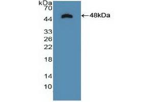 Detection of Recombinant NTRK2, Human using Polyclonal Antibody to Tropomyosin Receptor Kinase B (TrkB) (Tropomyosin Receptor Kinase B (AA 32-430) antibody)