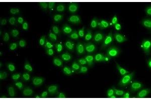Immunofluorescence analysis of U2OS cells using EWSR1 Polyclonal Antibody (EWSR1 antibody)