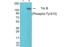 Western blot analysis of extracts from NIH/3T3 cells, using Trk B (phospho-Tyr515) antibody. (TRKB antibody  (pTyr515))