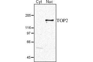 Image no. 1 for anti-DNA Topoisomerase II (TOP2) (C-Term), (N-Term) antibody (ABIN334538) (TOP2 antibody  (C-Term, N-Term))