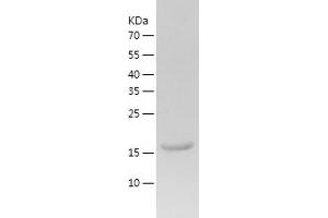 CNBP Protein (AA 1-170) (His tag)