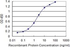 Detection limit for recombinant GST tagged SMS is 0. (SMS antibody  (AA 1-366))