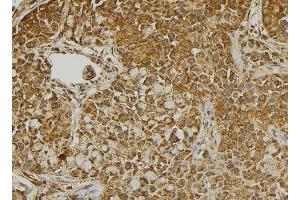 ABIN6273267 at 1/100 staining Human pancreas tissue by IHC-P. (MMP28 antibody  (Internal Region))