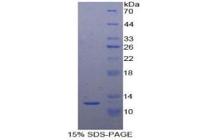 SDS-PAGE analysis of Chicken Semaphorin 3E Protein. (SEMA3E Protein)