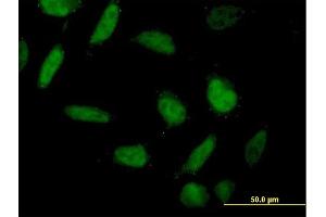 Immunofluorescence of purified MaxPab antibody to ING1 on HeLa cell. (ING1 antibody  (AA 1-279))