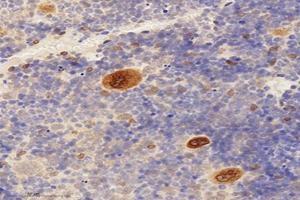 Immunohistochemistry analysis of paraffin-embedded mouse bone using,TMEM177 (ABIN7075996) at dilution of 1: 1000 (TMEM177 antibody)