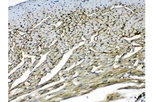 IHC analysis of Laminin using anti-Laminin antibody . (Laminin gamma 1 antibody  (all Isoforms))