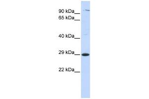 Tetraspanin 2 antibody used at 1 ug/ml to detect target protein. (Tetraspanin 2 antibody  (Middle Region))