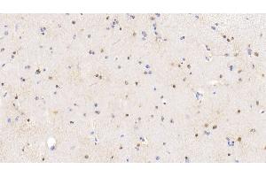 Detection of S100 in Bovine Cerebrum Tissue using Polyclonal Antibody to S100 Calcium Binding Protein (S100) (S100 Protein (S100) (AA 1-94) antibody)