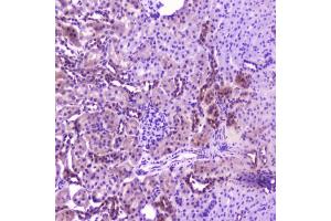 IHC testing of FFPE rat kidney with IL36A antibody at 2ug/ml. (IL36A/IL1F6 antibody  (AA 6-151))