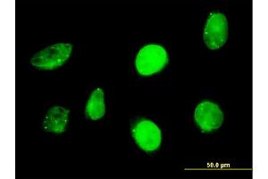 Immunofluorescence of monoclonal antibody to SP110 on HeLa cell. (SP110 antibody  (AA 271-380))