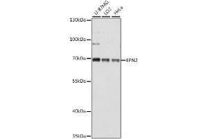 Western blot analysis of extracts of various cell lines using EPN2 Polyclonal Antibody at dilution of 1:1000. (Epsin 2 antibody)