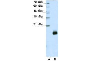 WB Suggested Anti-RPS14 Antibody Titration:  1. (RPS14 antibody  (N-Term))