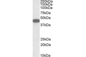 AP23738PU-N CXCR6 antibody staining of HEK293 lysate at 1 µg/ml (35µg protein in RIPA buffer). (CXCR6 antibody  (C-Term))