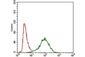 Immunohistochemical analysis of paraffin-embedded esophagus cancer tissues using ABCC4 antibody with DAB staining. (ABCC4 antibody  (AA 631-692))