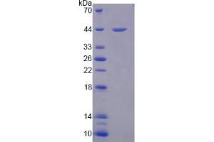 Image no. 1 for Defensin, alpha 1 (DEFA1) (AA 20-93) protein (His tag,GST tag) (ABIN6236779) (alpha Defensin 1 Protein (AA 20-93) (His tag,GST tag))