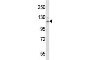 Western Blotting (WB) image for anti-Fms-Related tyrosine Kinase 3 (FLT3) (AA 154-181) antibody (ABIN3028662)