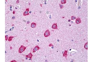 Anti-MLKL antibody IHC of human brain, cortex neurons. (MLKL antibody  (AA 371-472))