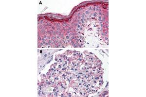 Immunohistochemical staining of formalin-fixed, paraffin-embedded human skin (A) and human kidney (B) tissue after heat-induced antigen retrieval. (Serotonin Receptor 1E antibody  (3rd Cytoplasmic Domain))