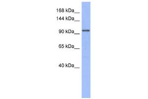 WB Suggested Anti-MSH4 Antibody Titration:  0. (MSH4 antibody  (N-Term))