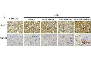 Immunohistochemistry (IHC) image for anti-SNAIL (SNAI1) (C-Term) antibody (ABIN6148177)