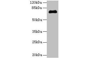 Western blot All lanes: PMEL antibody at 14 μg/mL + Jurkat whole cell lysate Secondary Goat polyclonal to rabbit IgG at 1/10000 dilution Predicted band size: 71, 61, 67 kDa Observed band size: 71 kDa (Melanoma gp100 antibody  (AA 25-467))