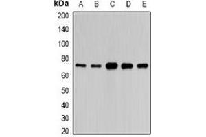 Western blot analysis of PAIP1 expression in HepG2 (A), A549 (B), mouse liver (C), mouse kidney (D), rat brain (E) whole cell lysates. (PAIP1 antibody)