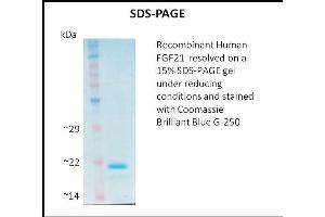 SDS-PAGE (SDS) image for Fibroblast Growth Factor 21 (FGF21) (Active) protein (ABIN5509462) (FGF21 Protein)