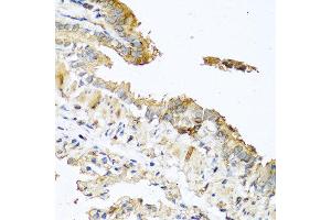 Immunohistochemistry of paraffin-embedded mouse lung using RNASE11 antibody at dilution of 1:100 (40x lens).
