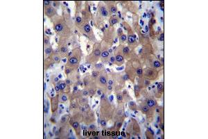 MLXIPL Antibody (C-term) (ABIN656493 and ABIN2845770) immunohistochemistry analysis in formalin fixed and paraffin embedded human liver tissue followed by peroxidase conjugation of the secondary antibody and DAB staining. (MLXIPL antibody  (C-Term))