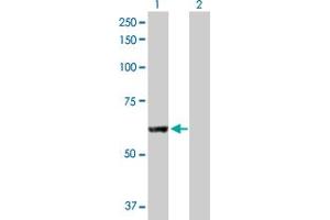 Western Blot analysis of PNPLA2 expression in transfected 293T cell line by PNPLA2 MaxPab polyclonal antibody. (PNPLA2 antibody  (AA 1-504))