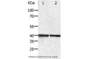 Western blot analysis of Hela and Jurkat cell, using PDX1 Polyclonal Antibody at dilution of 1:450 (PDX1 antibody)