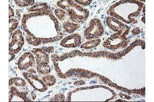 Image no. 1 for anti-Ribophorin 1 (RPN1) antibody (ABIN1500749) (RPN1 antibody)