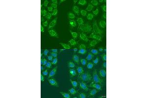 Immunofluorescence analysis of U2OS cells using HSD17B3 antibody (ABIN2736919) at dilution of 1:100.