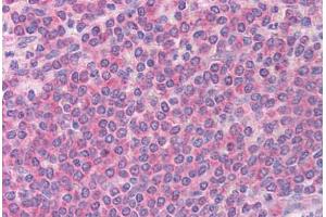 Human Spleen (formalin-fixed, paraffin-embedded) stained with BCL2L11 antibody ABIN213909 at 5 ug/ml followed by biotinylated goat anti-rabbit IgG secondary antibody ABIN481713, alkaline phosphatase-streptavidin and chromogen. (BIM antibody  (Internal Region))