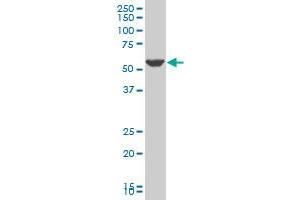 PTGIS polyclonal antibody (A01), Lot # 050921JC01 Western Blot analysis of PTGIS expression in NIH/3T3 . (PTGIS antibody  (AA 391-500))