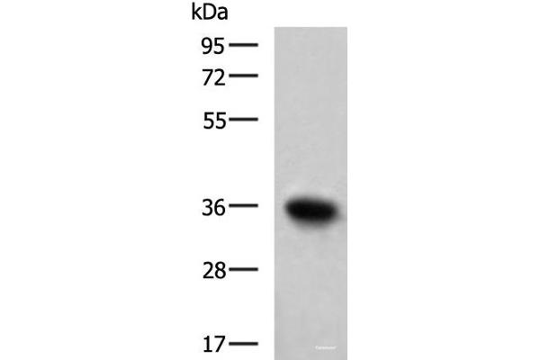 TNNT1 antibody