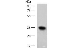 Western blot analysis of Mouse skeletal muscle tissue lysate using TNNT1 Polyclonal Antibody at dilution of 1:550 (TNNT1 antibody)