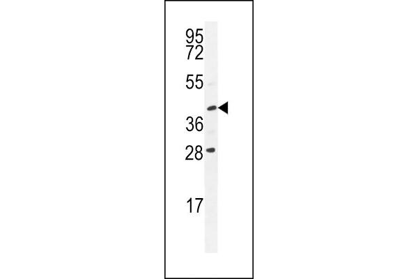 USP50 anticorps  (AA 141-169)