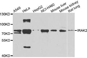 Western blot analysis of extracts of various cell lines, using IRAK2 antibody (ABIN5975418) at 1/1000 dilution. (IRAK2 antibody)