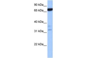 Western Blotting (WB) image for anti-Zinc Finger Protein 340 (ZNF340) antibody (ABIN2463360) (ZBTB46 antibody)