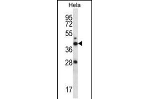 Western blot analysis in Hela cell line lysates (35ug/lane). (RAD23A antibody  (N-Term))