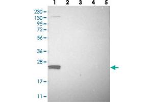 Western blot analysis of Lane 1: RT-4, Lane 2: U-251 MG, Lane 3: Human Plasma, Lane 4: Liver, Lane 5: Tonsil with FAM213A polyclonal antibody . (FAM213A antibody)